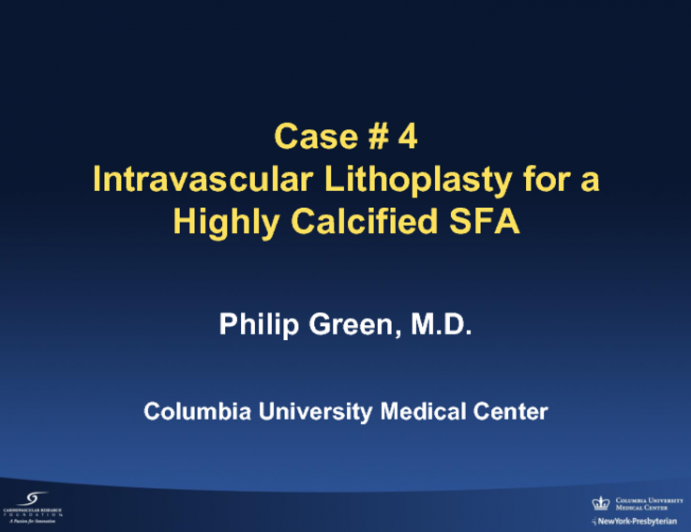 Case #4: Intravascular Lithoplasty for a Highly Calcified SFA