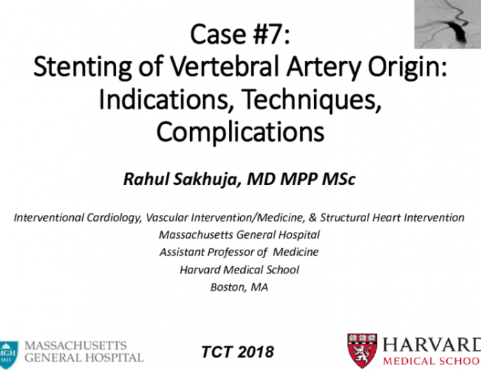 Case #7: Stenting of Vertebral Artery Origin: Indications, Techniques, Complications