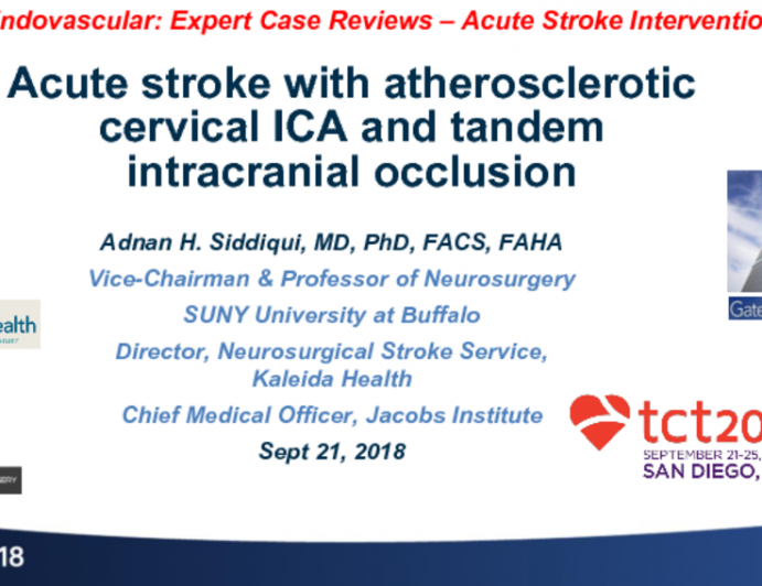 Case #3: Acute Stroke With Atherosclerotic ICA Occlusion and Intracranial Occlusion