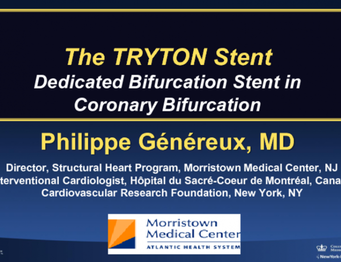 Planned 2-Stent Technique Step-by-Step: How to Use Tryton