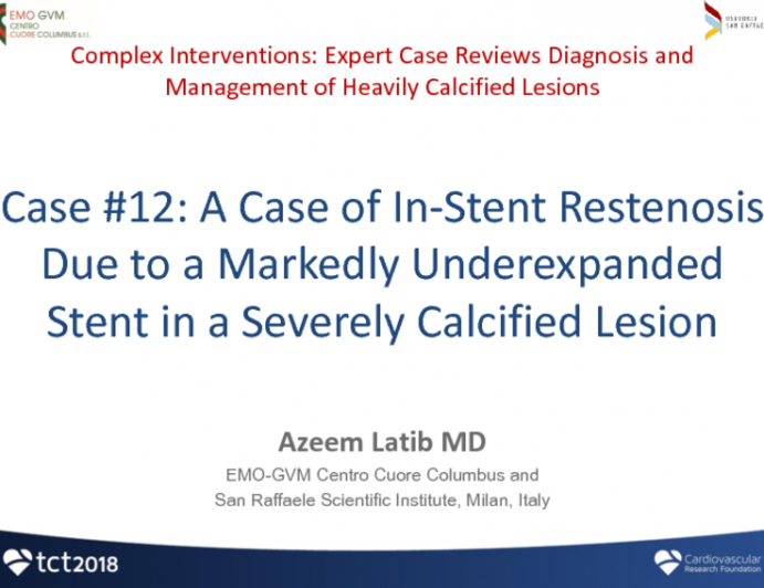 Case #12: A Case of In-Stent Restenosis Due to a Markedly Under-expanded Stent in a Severely Calcified Lesion