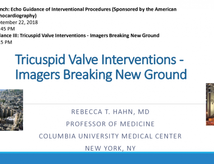 Imaging Guidance III: Tricuspid Valve Interventions - Imagers Breaking New Ground