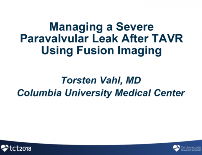 Case #5: Managing a Severe Paravalvular Leak After TAVR Using Fusion Imaging