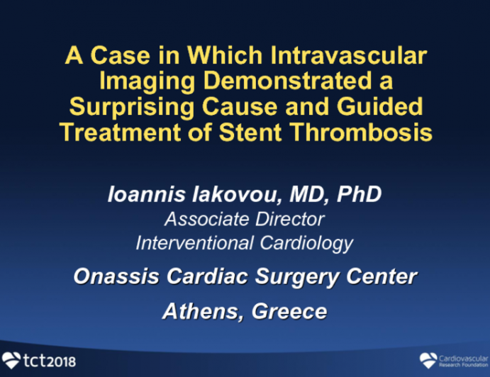 Case #9: A Case in Which Intravascular Imaging Demonstrated a Surprising Cause and Guided Treatment of Stent Thrombosis