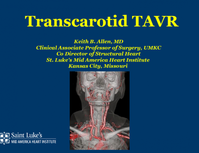 Case #6: Trans-Carotid TAVR Step-by-Step