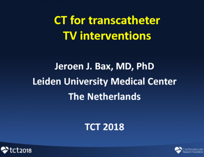 Tricuspid is the “Forgotten Valve” No More – TR Natural History Reflections and Rationale for Treatment