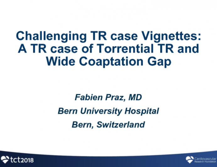Case Presentation: A TR Case of… Torrential TR and Wide Coaptation GAP