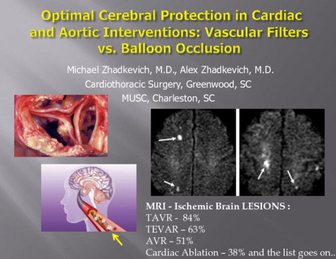 TCT-88: Optimal Cerebral Protection in Cardiac and Aortic Interventions: Vascular Filters vs. Balloon Occlusion?