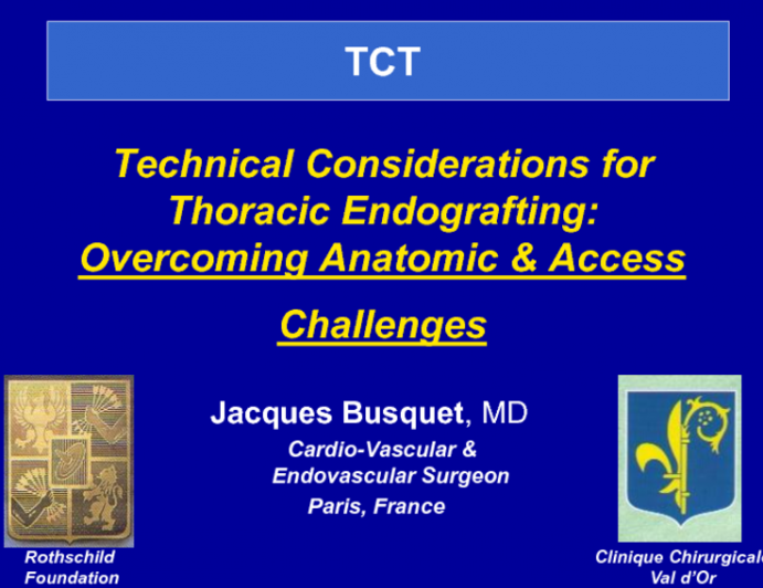 France Presents: Our Most Common Approach to Aortic Dissection