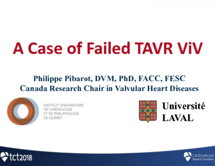 Case #6: A Case of Failed TAVR ViV