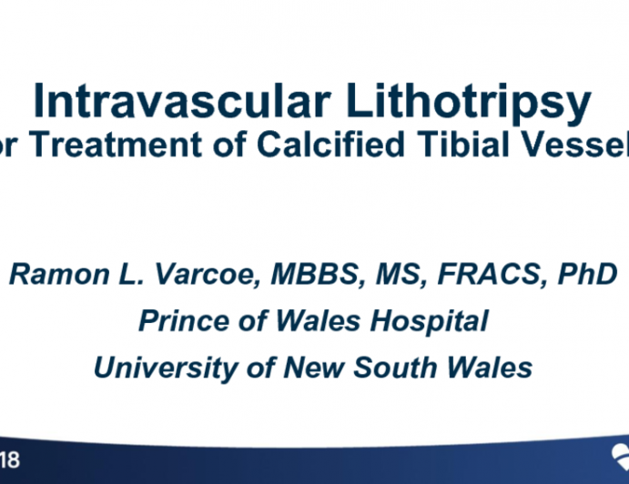 Intravascular Lithotripsy for Treatment of Calcified Tibial Vessels