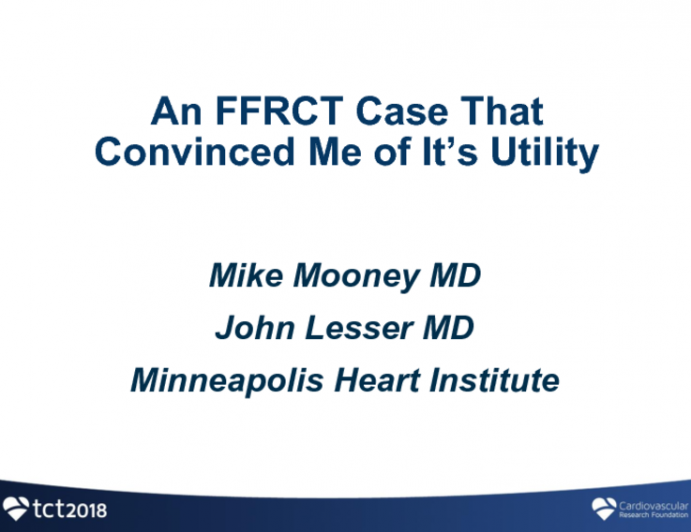 Case #1: An FFRCT Case That Convinced Me of It's Utility