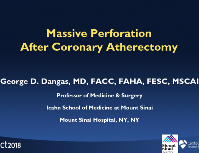 Massive Perforation After Coronary Atherectomy