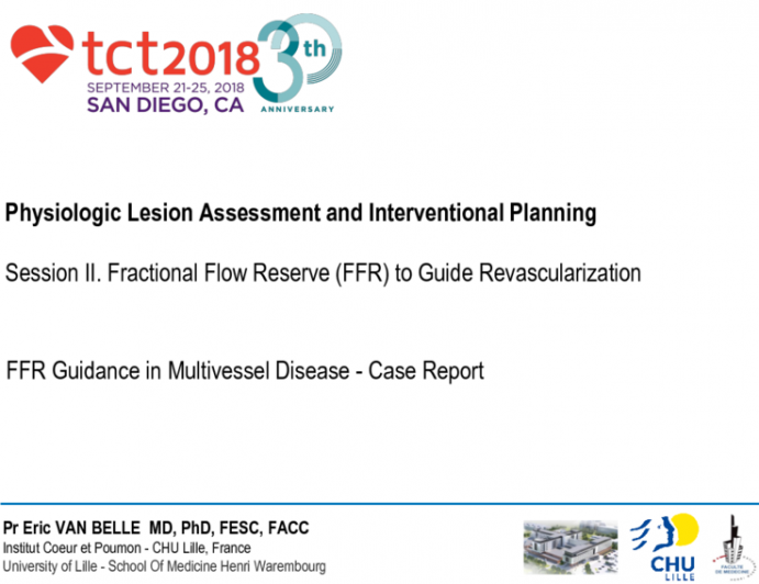 Physiology Case Vignette #3: FFR Guidance in Multivessel Disease