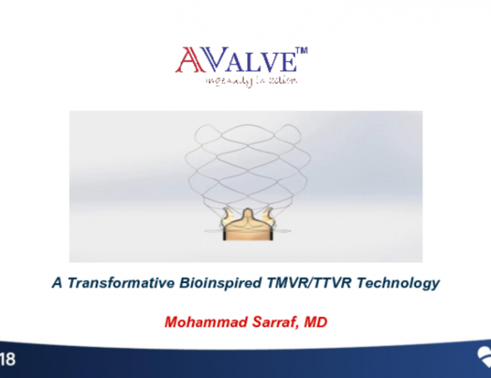 A Bioinspired Transcatheter Mitral Valve Replacement System: AValve