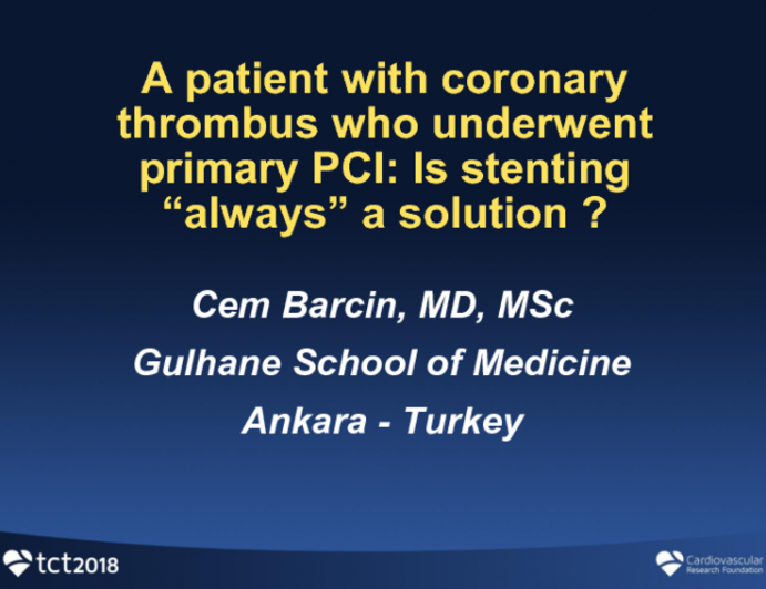 Turkey Presents: A Patient With Coronary Thrombus Undergoing Primary PCI for STEMI - Is Stenting Always a Solution?