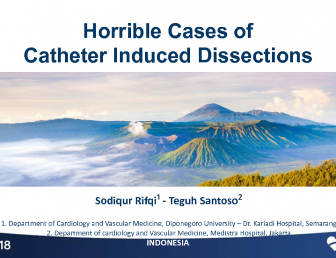 Case #1: From Indonesia: Catheter Induced Dissection With Acute Vessel Closure, Aortic Dissection, and Perforation