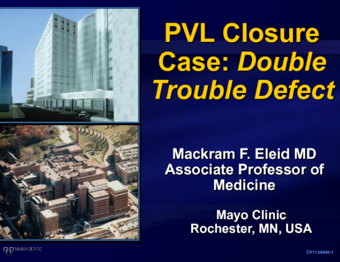 Case #6: Closing Right-Sided Paravalvular Leaks: A Case of Tricuspid PVL Closure