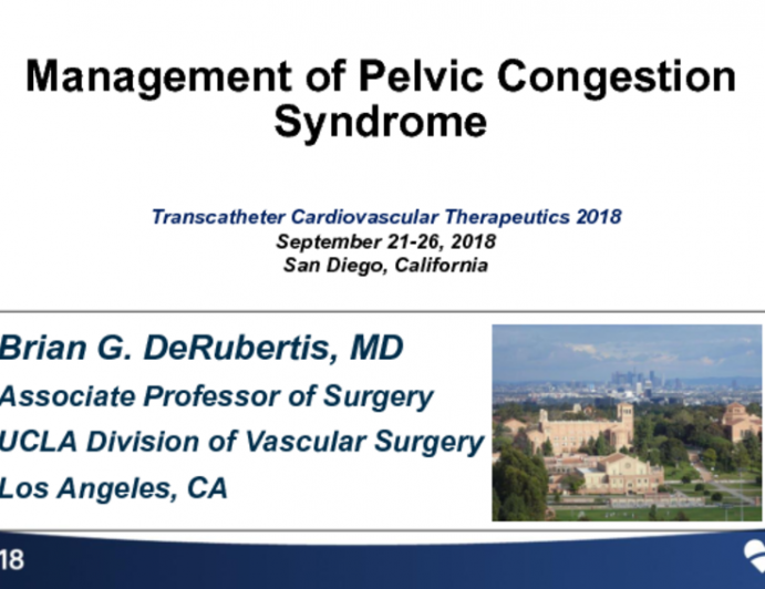 Management of Pelvic Congestion Syndrome (With Case Reviews)