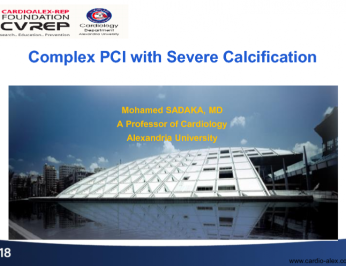 Case #2: Complex Multivessel PCI With Severely Calcified Lesions