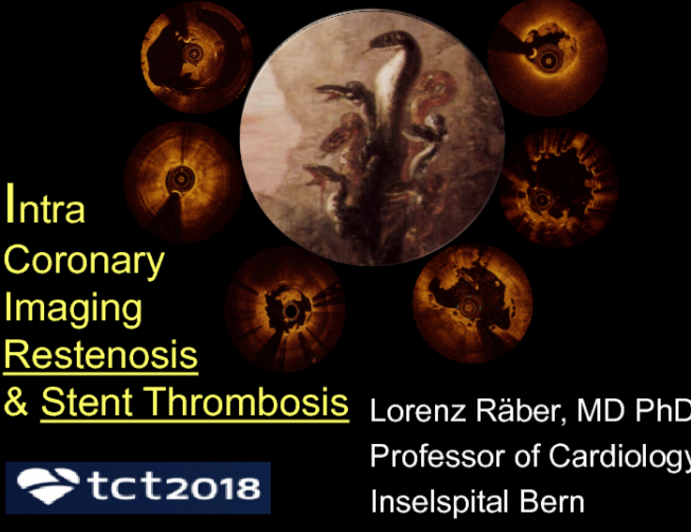 Intravascular Imaging to Evaluate Stent Thrombosis and Restenosis