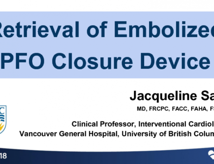 Case #8: Retrieval of an Embolized PFO Closure Device