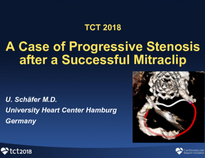 Case #1: A Case of Progressive Stenosis After a Successful MitraClip