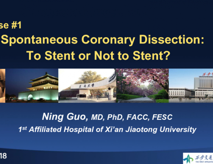 Case #1 – Spontaneous Coronary Dissection: To Stent or Not to Stent?