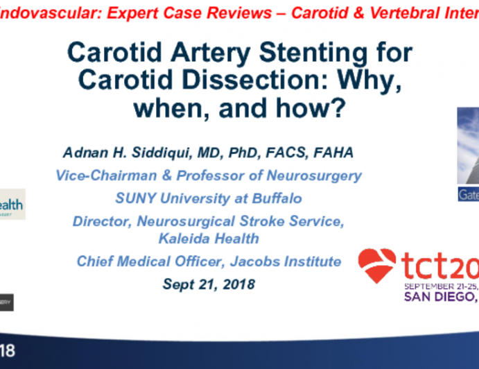 Case #4: Carotid Artery Stenting for Carotid Artery Dissection: Why, When, and How