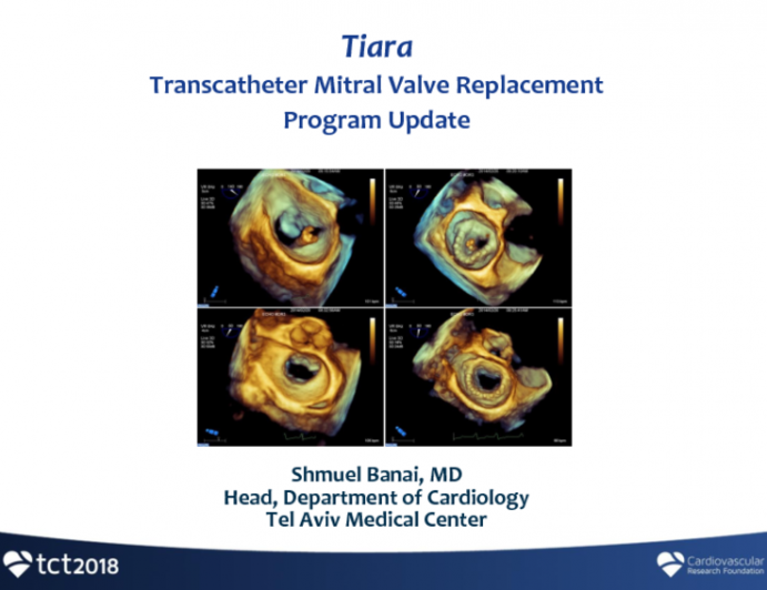 Tiara: Device Attributes, Implant Procedure, and Clinical Results