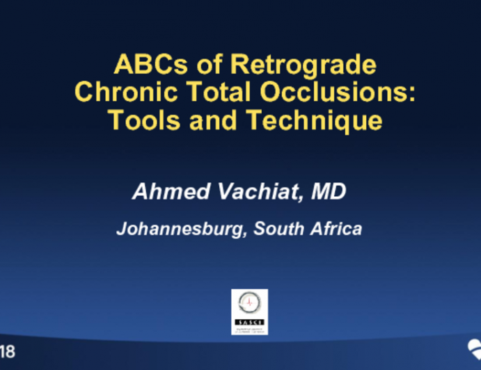 ABCs of Retrograde: Tools and Technique