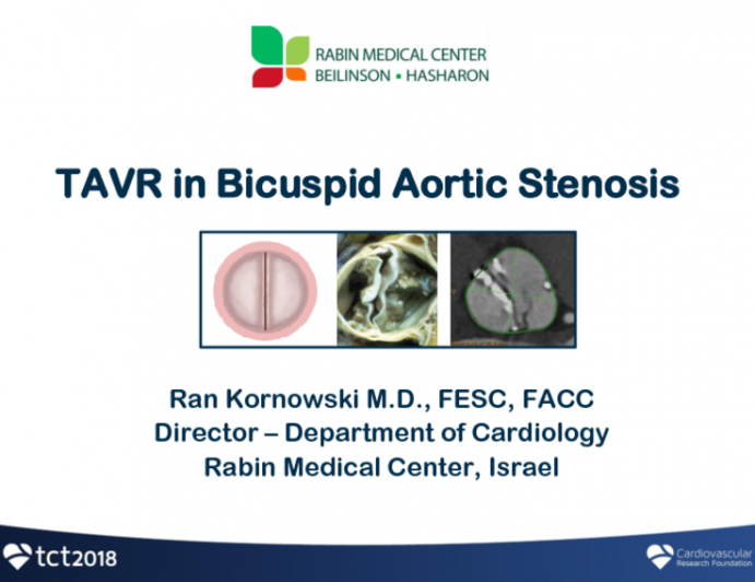 Bicuspid Aortic Stenosis: How To Treat