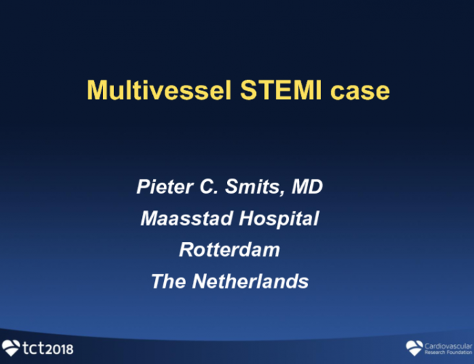 STEMI With Multivessel Disease: How To Proceed?