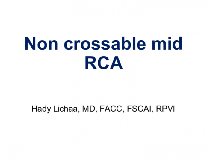 Non crossable mid RCA