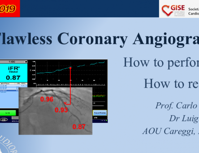 A Flawless Coronary Angiography 