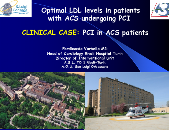 Optimal LDL levels in patients with ACS undergoing PCI