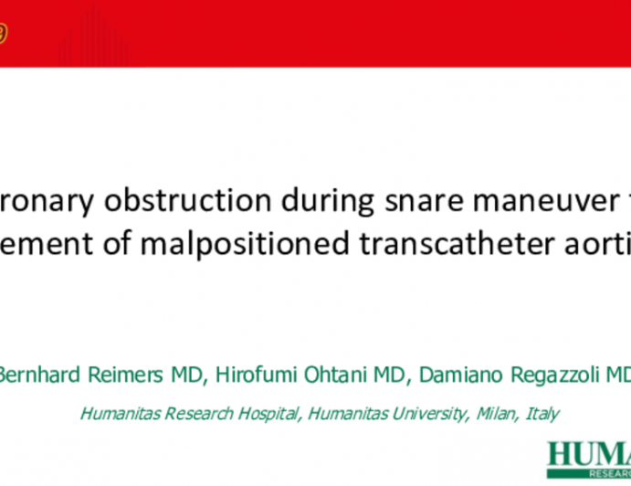 Coronary obstruction during snare maneuver for management of malpositioned transcatheter aortic valve