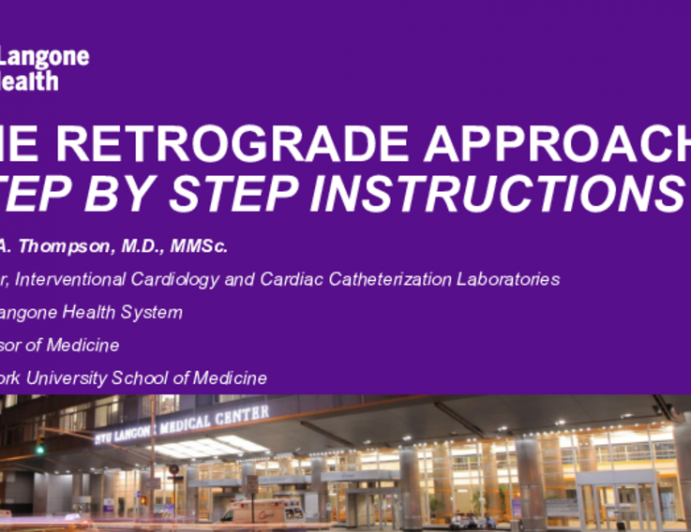 The Retrograde Approach: Step-by-step Instructions