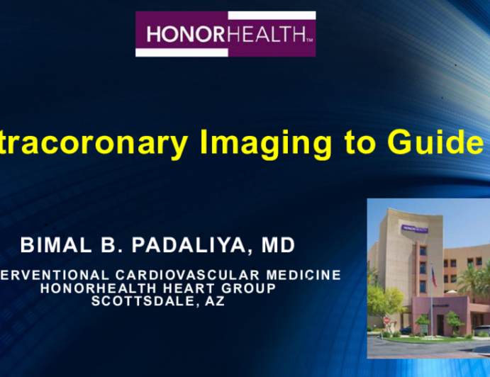 Intracoronary Imaging to Guide PCI