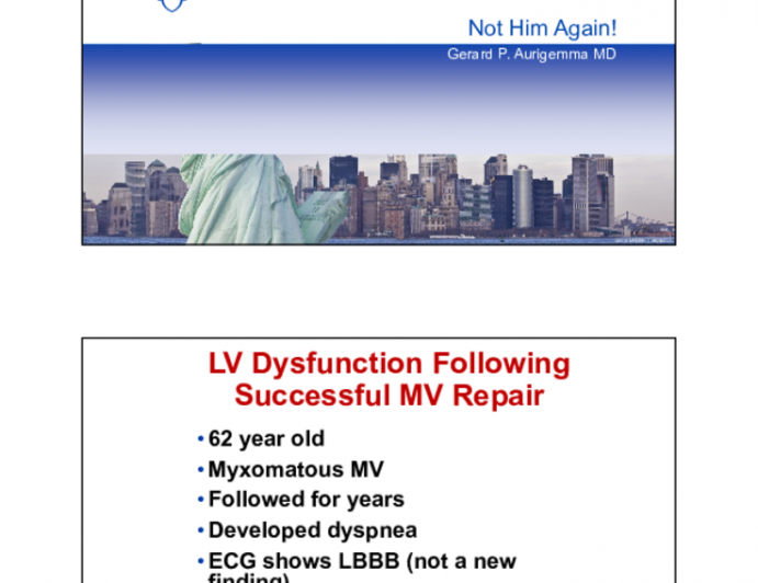  LV Dysfunction Following Successful MV Repair