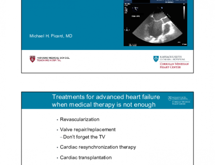 Echocardiography for LVAD and Heart Transplantation