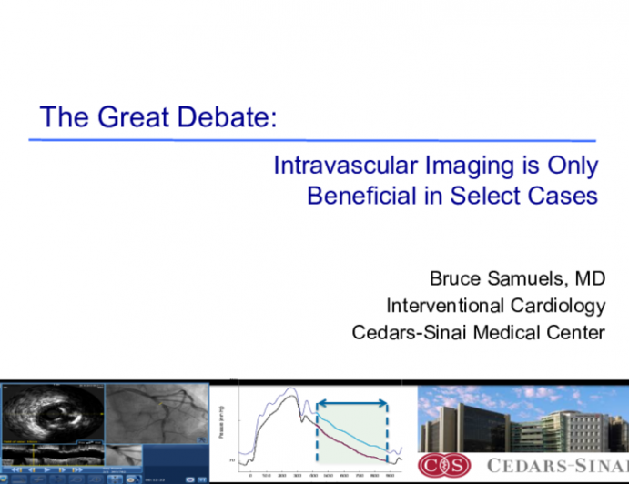 The Great Debate: Intravascular Imaging is Only Beneficial in Select Cases 