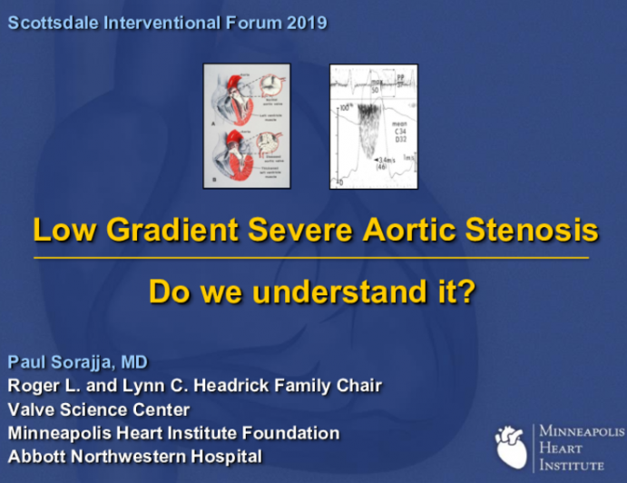 Low Gradient Severe Aortic Stenosis - Do we understand it?
