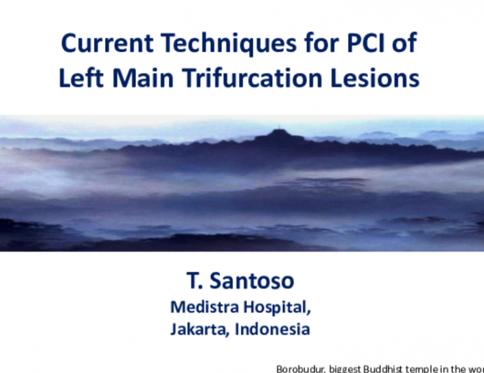 Current Techniques for PCI of Left Main Trifurcation Lesions 