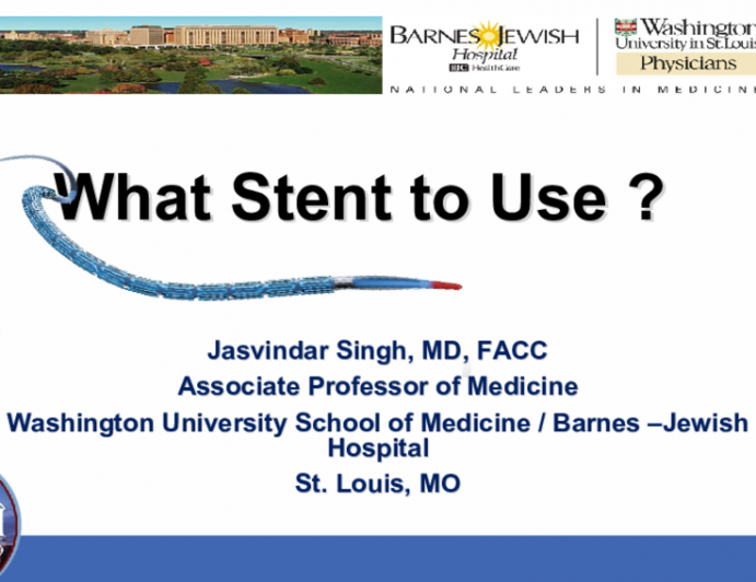 What Stent to Use ?