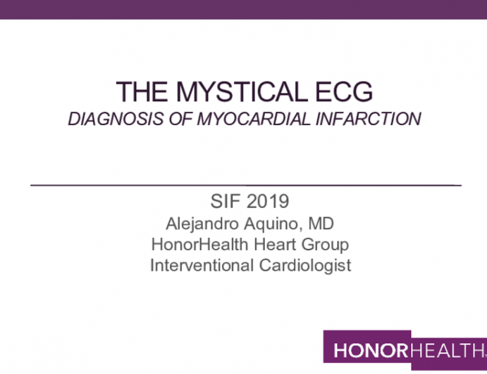 The Mystical ECg Diagnosis of myocardial infarction