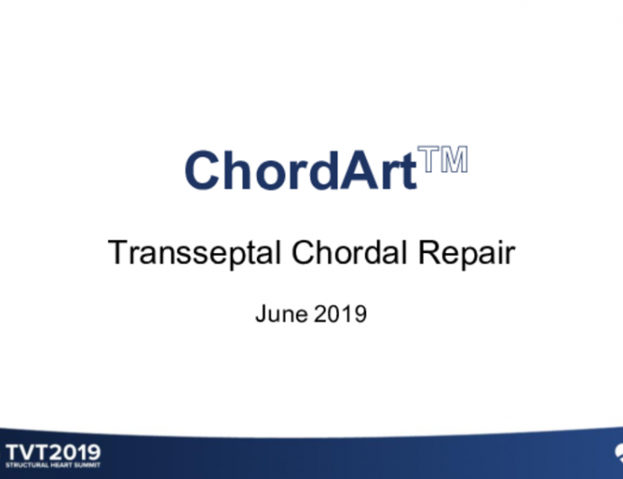 Chordart