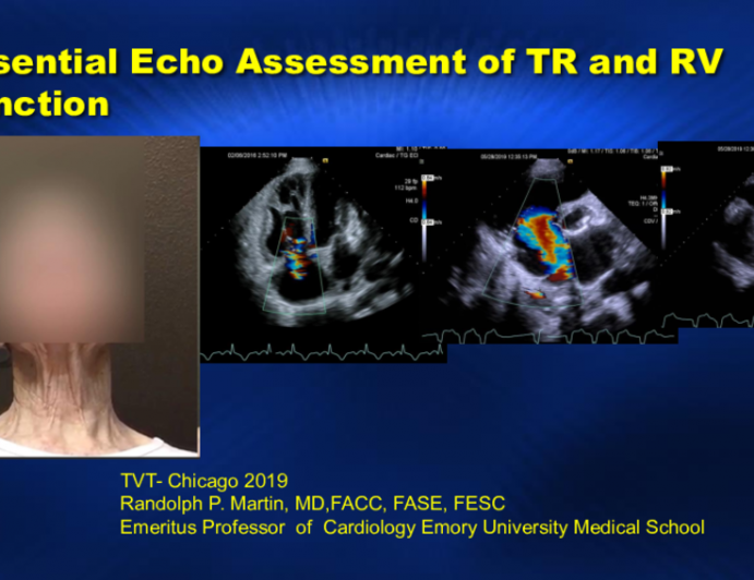 The ‘Essential’ Echocardiography Examination of TR and RV Function