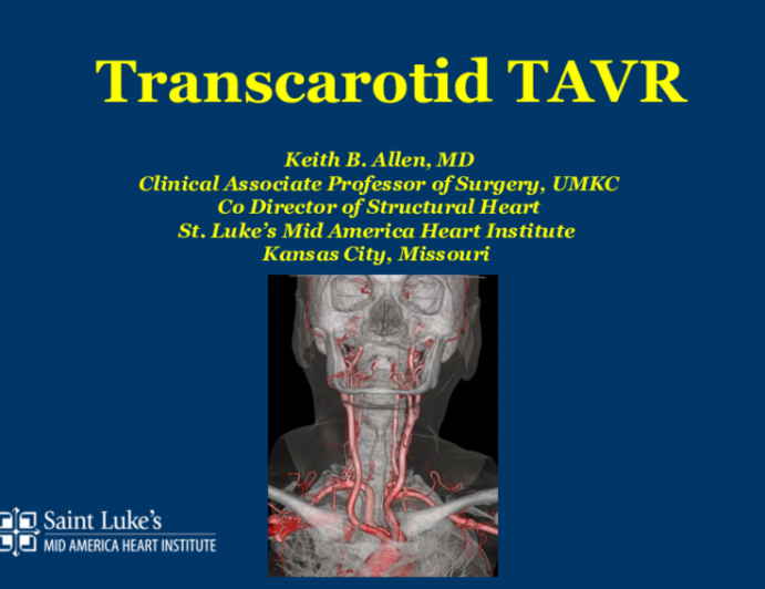 Transcarotid Is My Preferred Alternative Access for TAVR