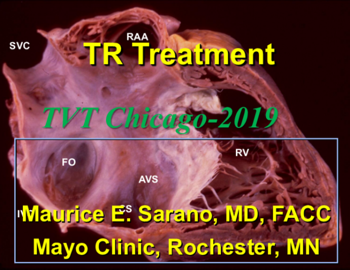 Medical Therapy for TR and Indications (Thresholds) for Surgical/Transcatheter Therapies